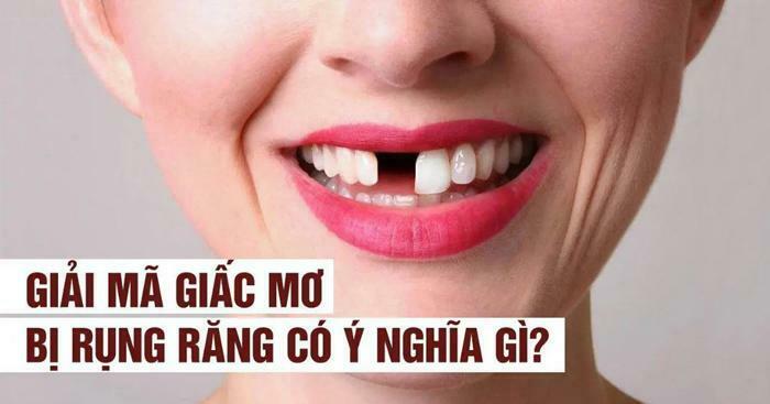 Chiêm bao thấy bị rụng nhiều răng